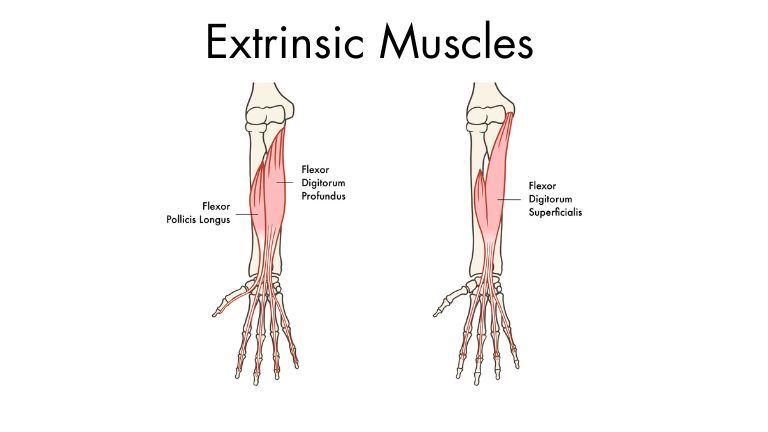 Extrinsic Muscles in Hand for Trigger Finger