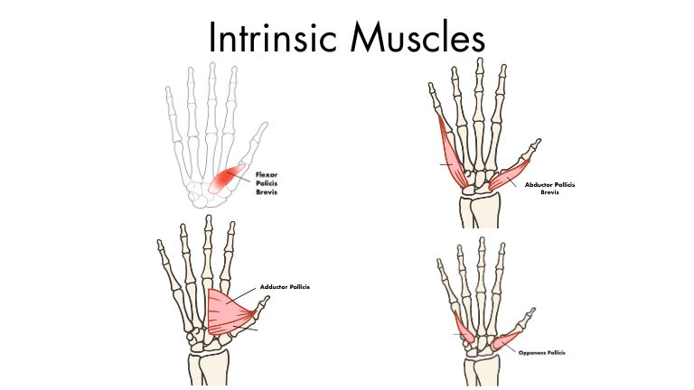 Intrinsic Muscles for Trigger Finger