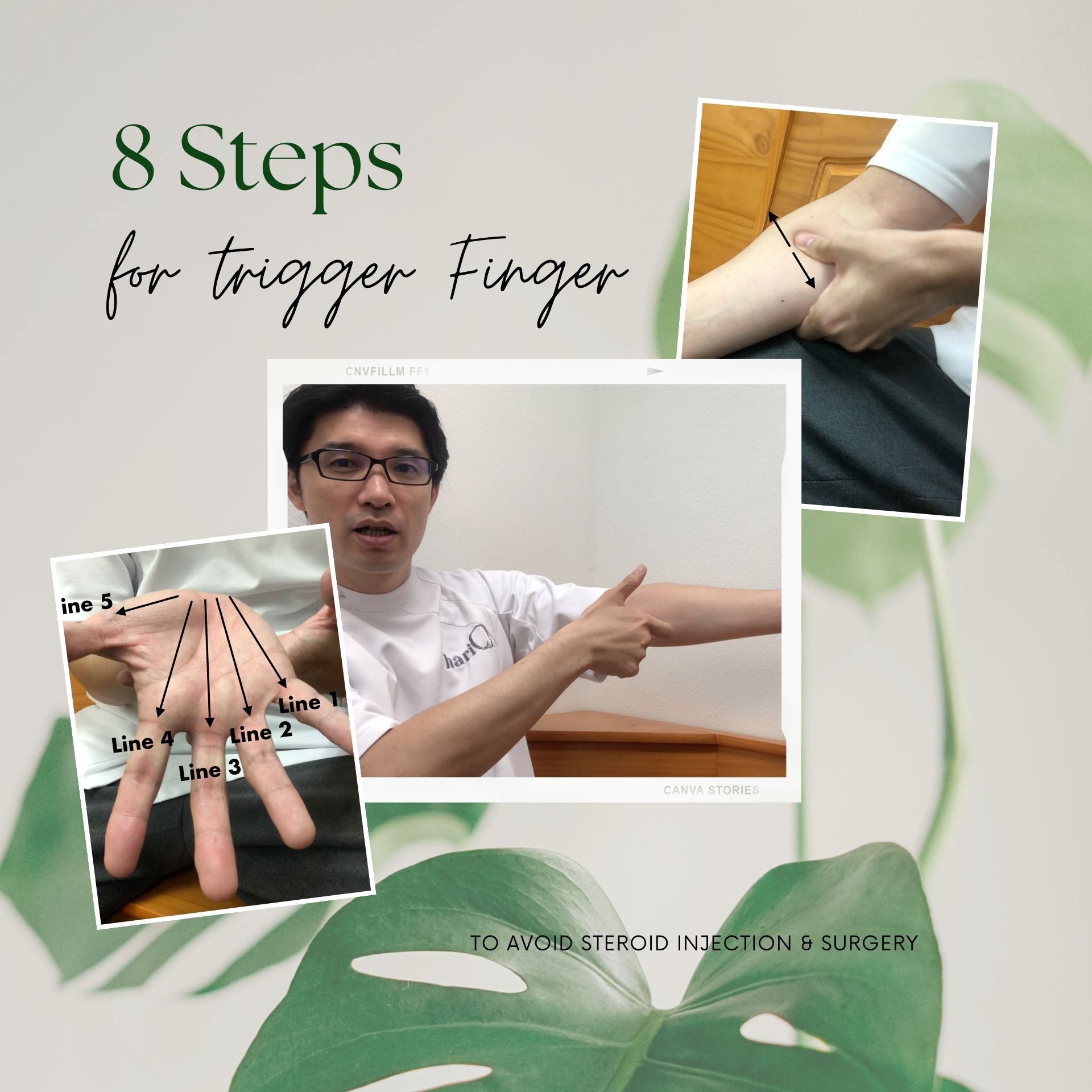 Easy 8 Steps of Massage & Stretch for Your Trigger Finger