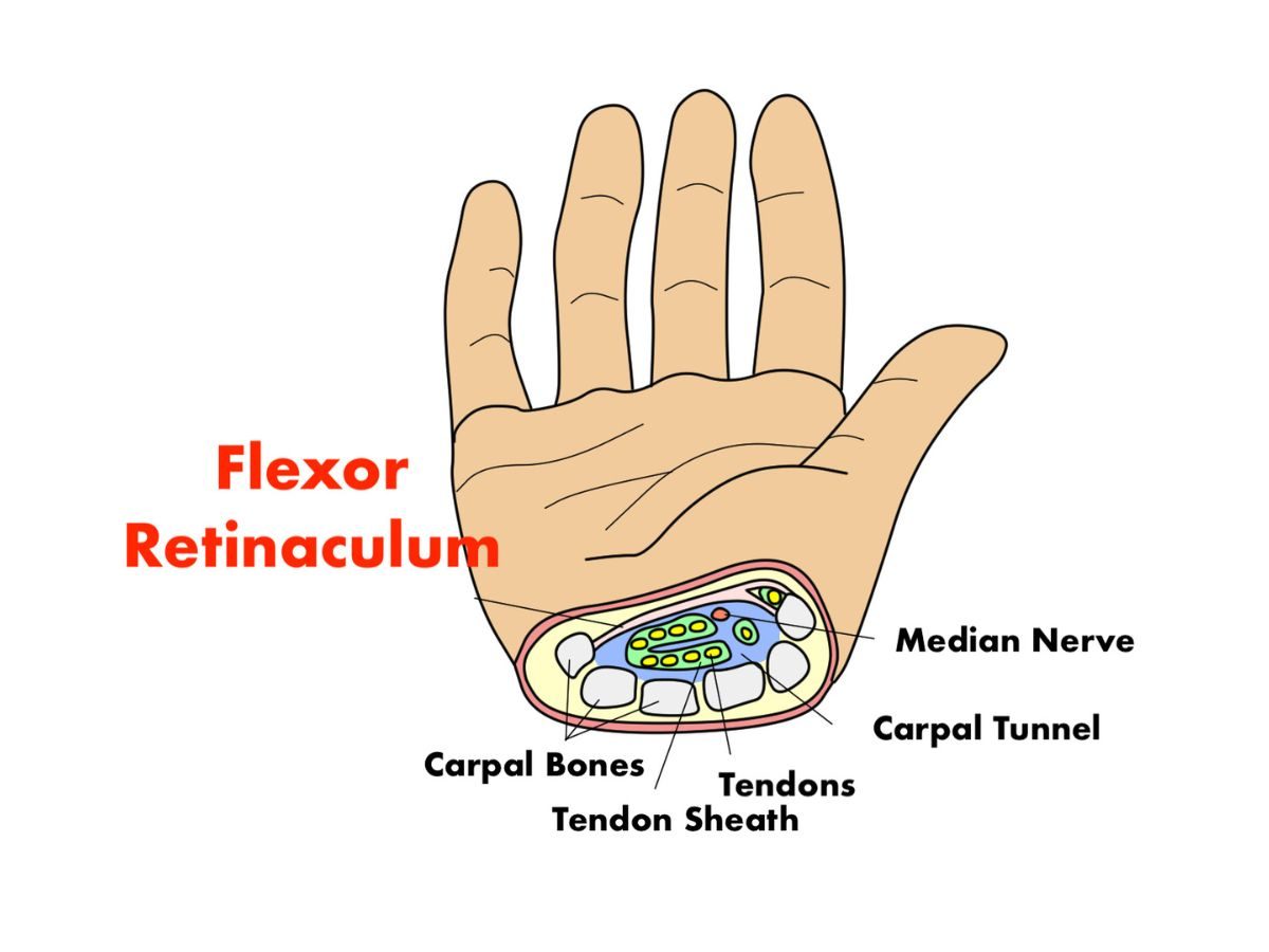 What is Carpal Tunnel Syndrome?