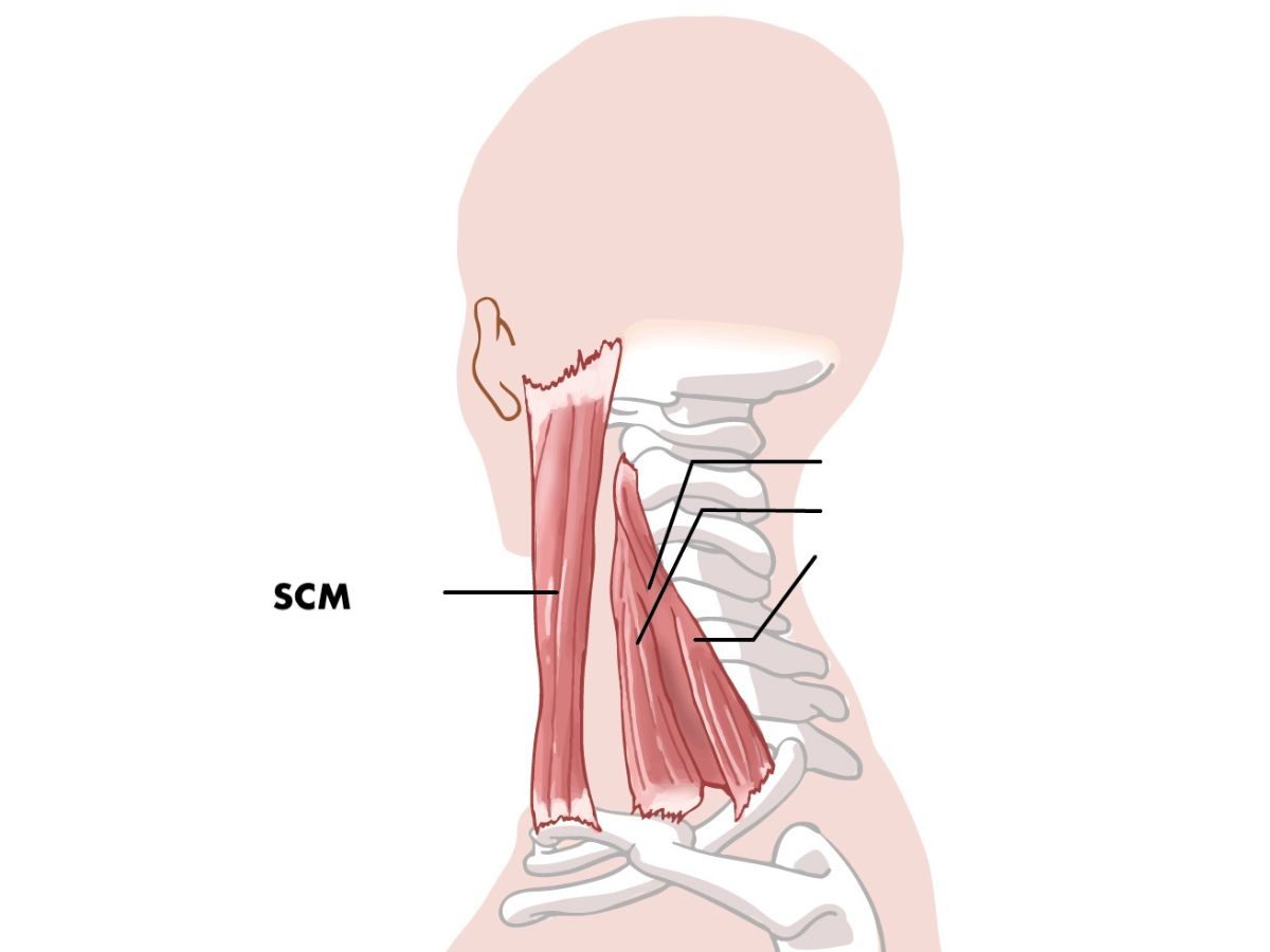 SCM