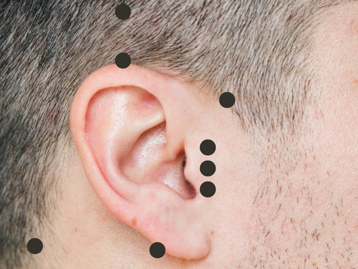 10 Acupressure points for Tinnitus