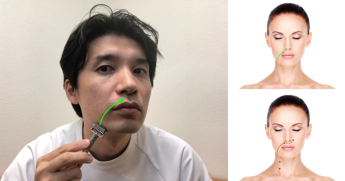 Facial Roller Exercise No. 3 for Bell's Palsy