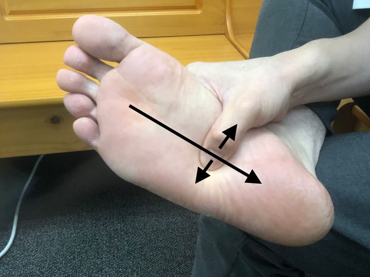 Foot Massage on Line 2 (Part 2) for Plantar Fasciitis