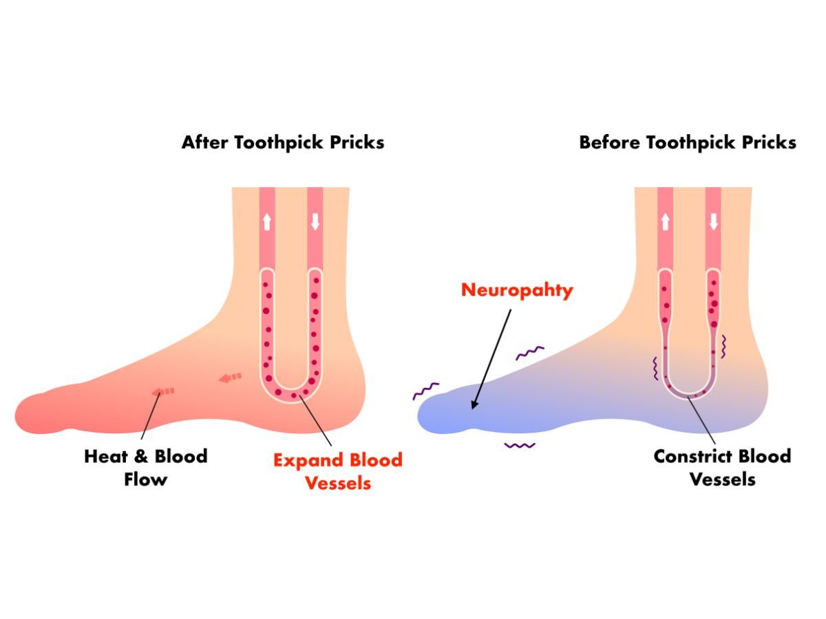 Benefits of toothpick pricks