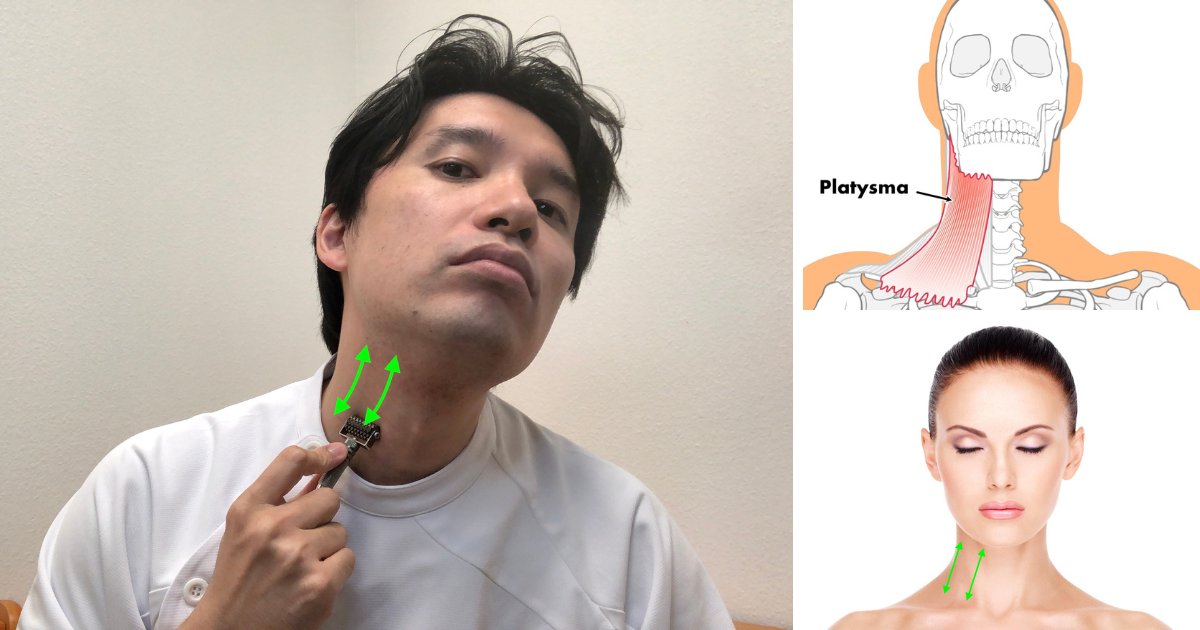 Facial Roller Exercise No. 9 for Bell's Palsy