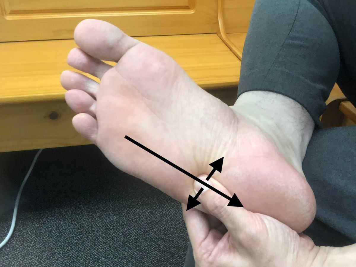 Foot Massage on Line 3 (part 2) for Plantar Fasciitis