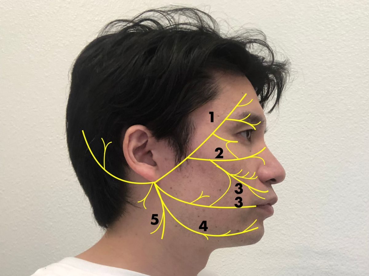 5 branches of Facial Nerve